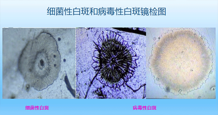 虾疫病球盟会官网入口机构